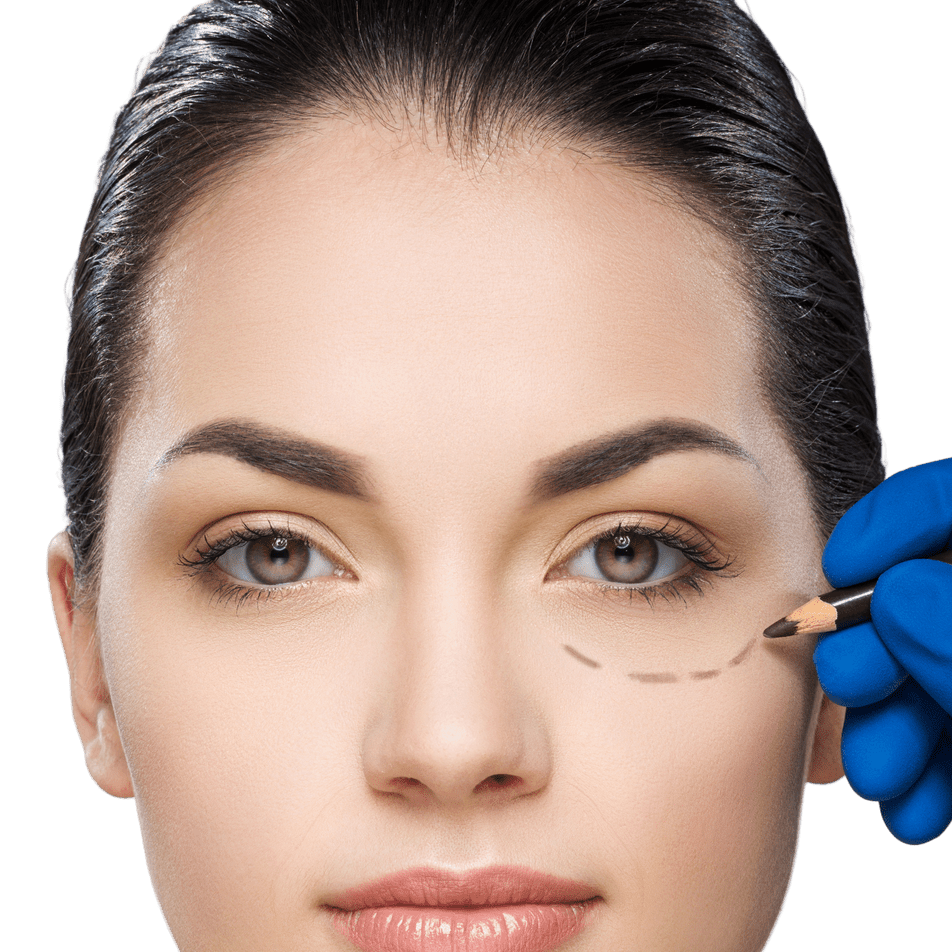 Correction of Hollow Eyes