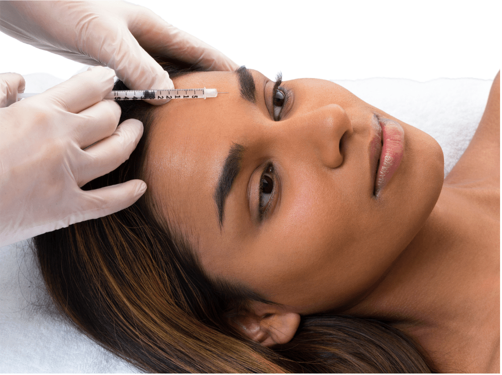 Botox Injections (Face)