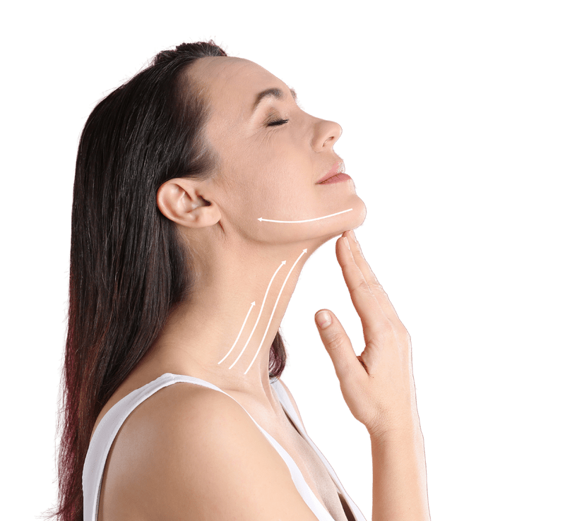 CAA Vector Facelift®