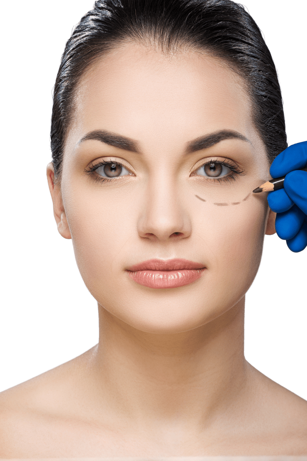 Correction of Hollow Eyes