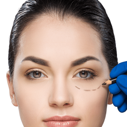 Correction of Hollow Eyes