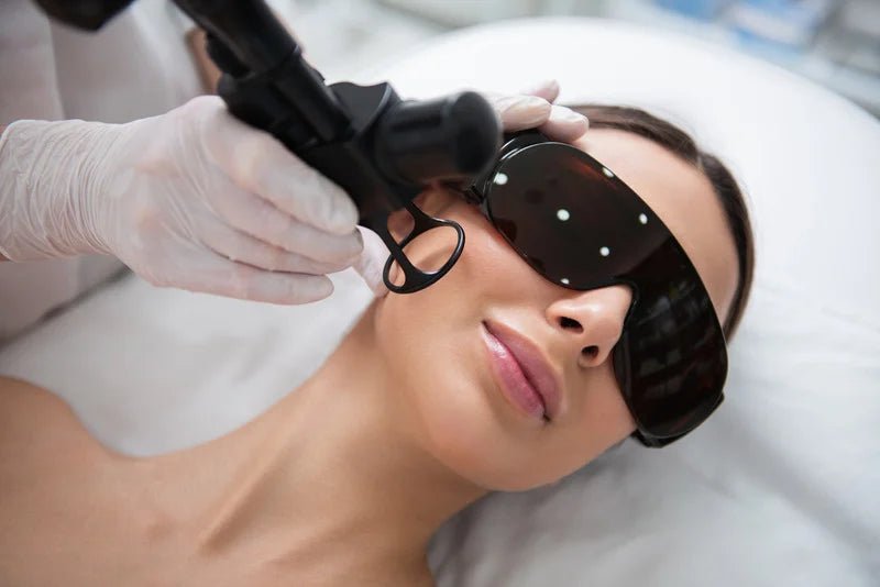 Exo - Laser Scar Revision