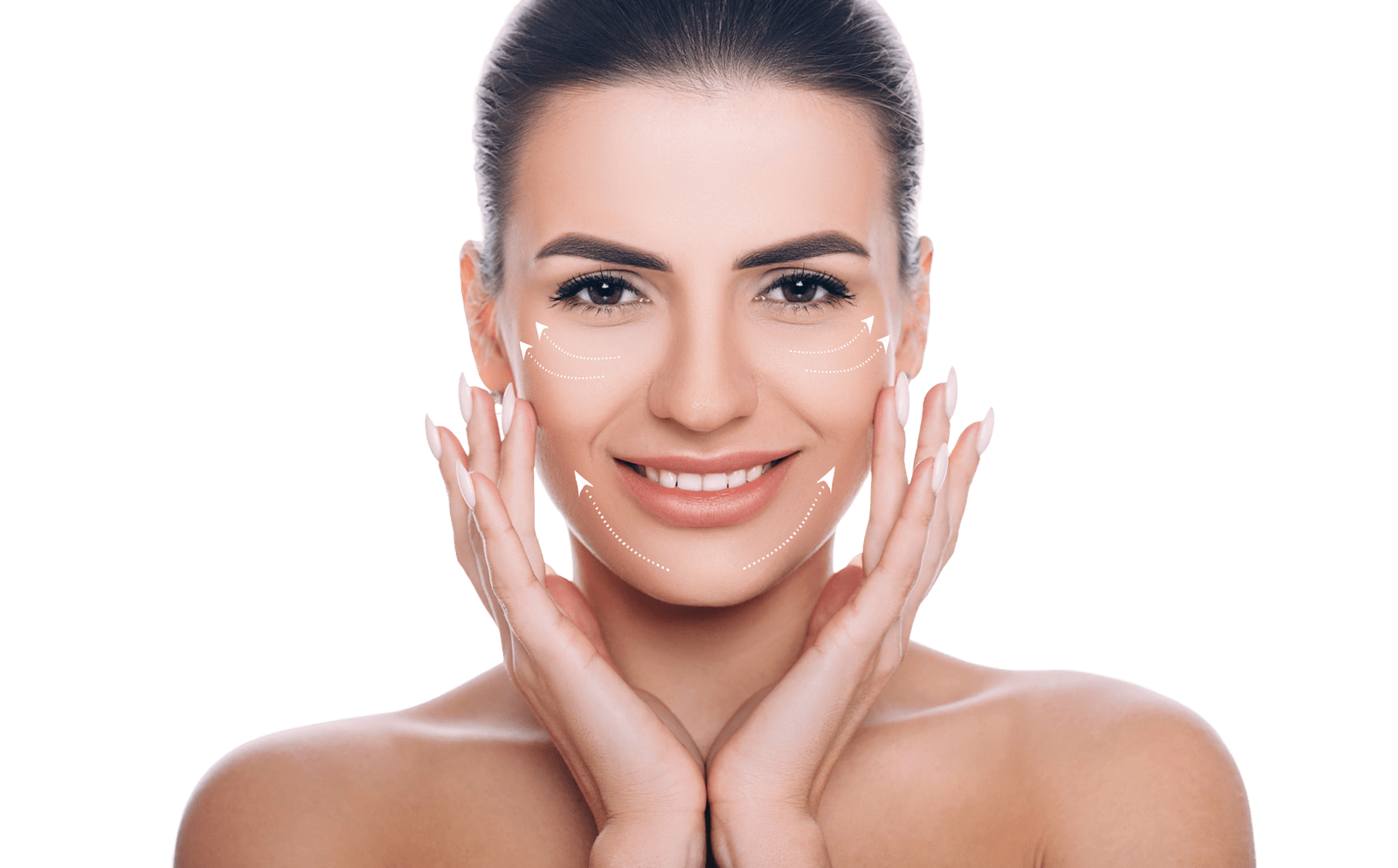Midface Lift (Cog)