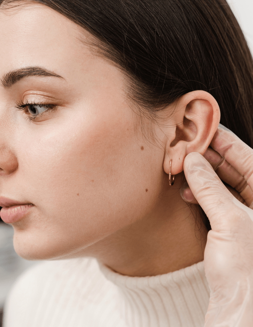 Otoplasty